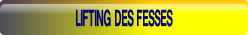 wp93a20559.png